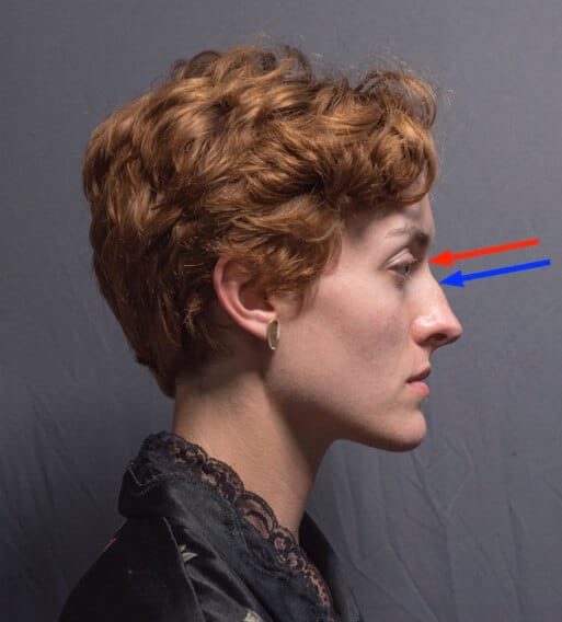 The root of the nose is marked here in red, the bridge of the nose terminates lower, at the end of the nasal bones, marked here in blue.