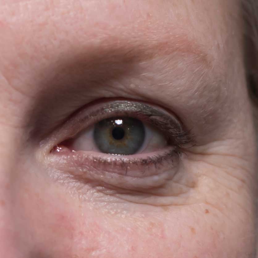 Reference photo of an eye in front view.