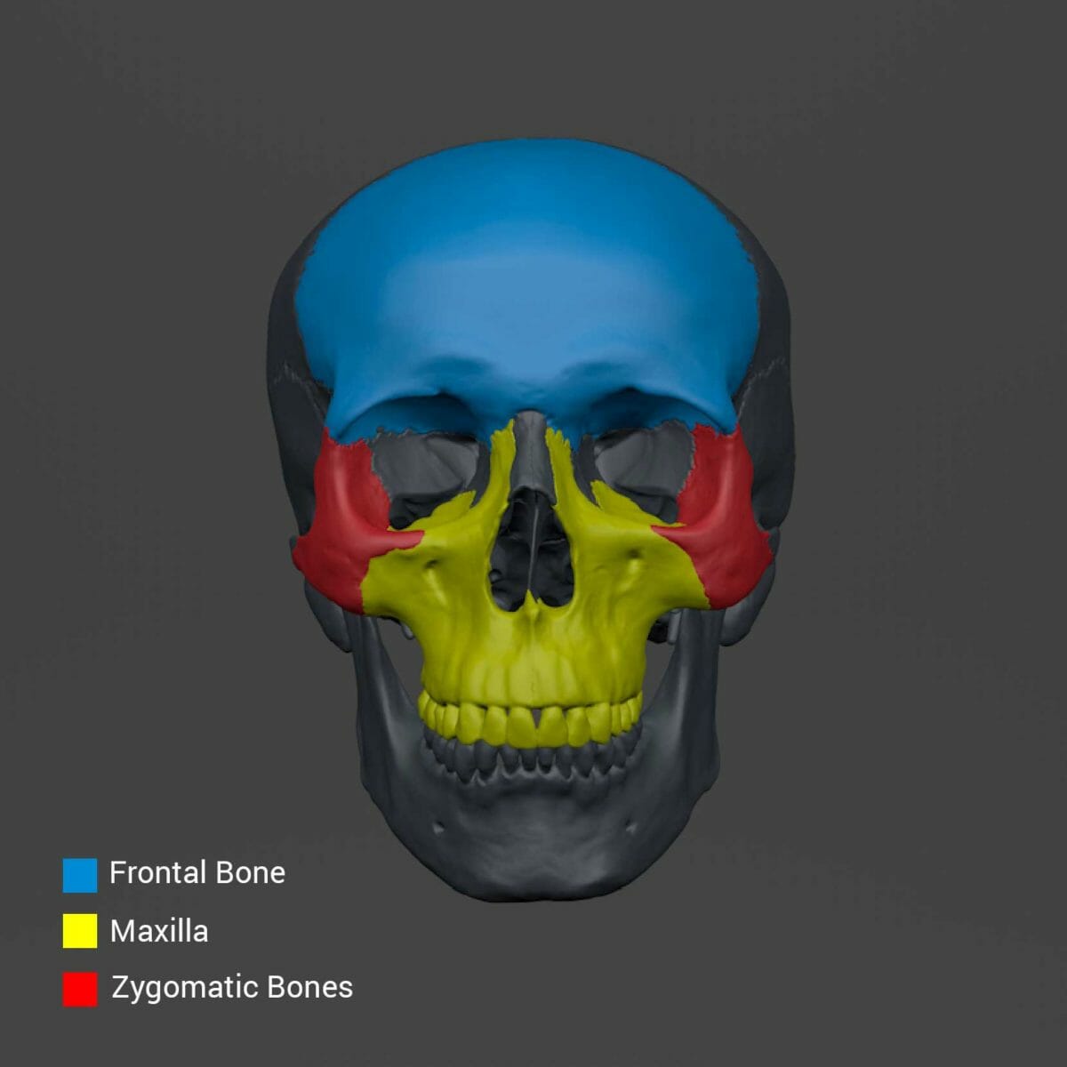 Diagram showing the bony structures surrounding the eye socket.